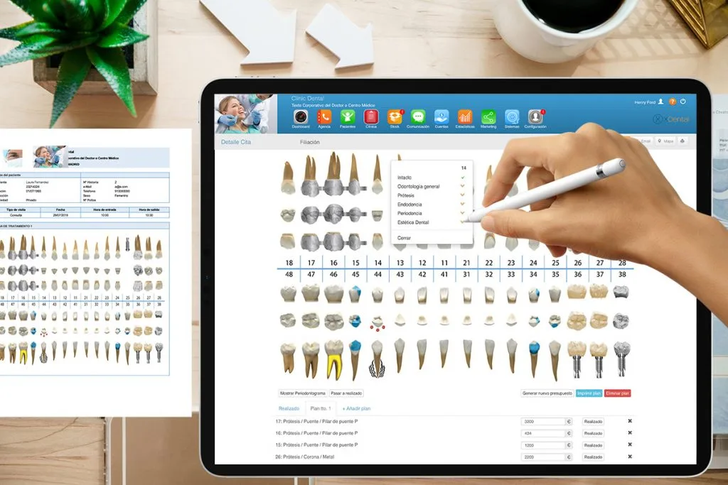 Software-dental