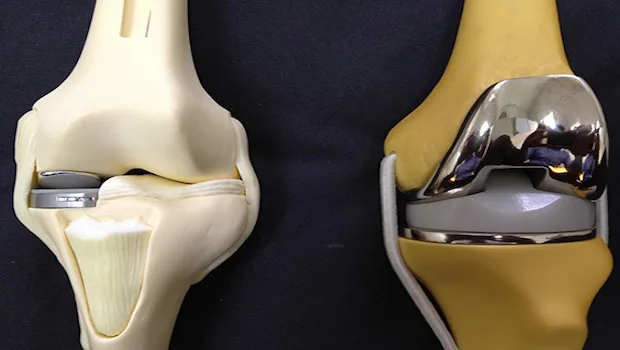 protesis rodilla